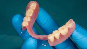 Protesis dental removible